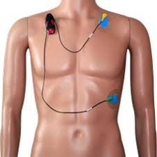 ECG HOLTER MONITORING